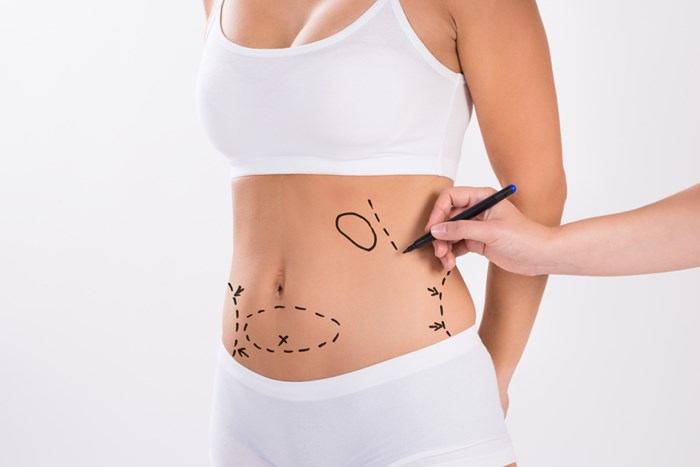 ¿Cómo funciona el coolsculpting?  |  Qué hacer y qué no hacer con Coolsculpting |  Su belleza