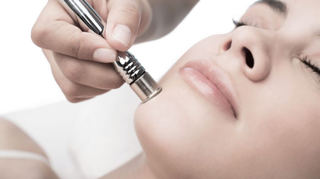 Efectos secundarios |  ¿Qué es la microdermoabrasión y mejorará su piel?  Su belleza