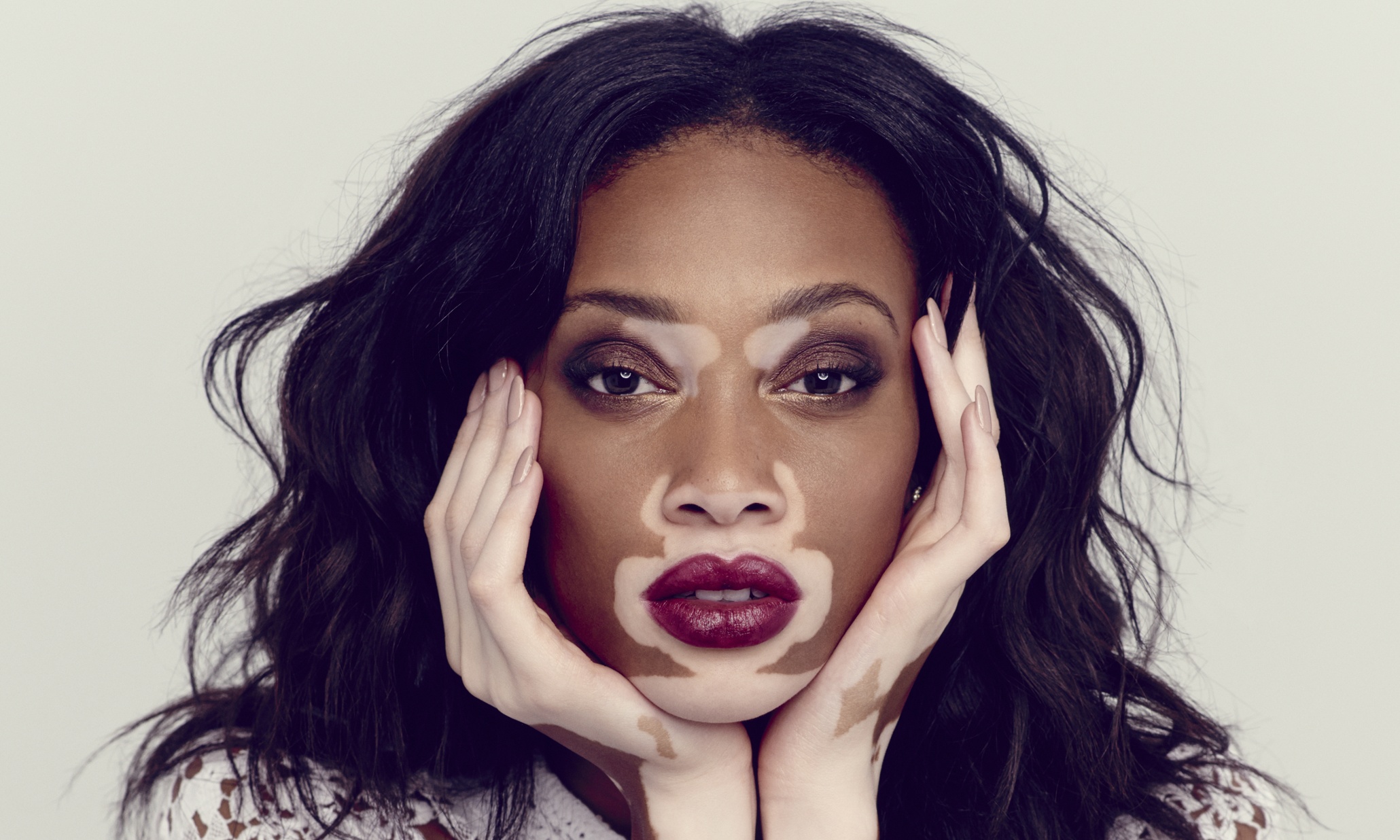 1. Winnie Harlow (nacida como Chantelle Brown-Young)